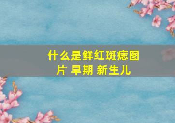 什么是鲜红斑痣图片 早期 新生儿